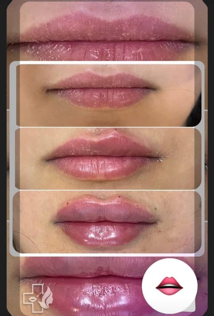 کلینیک تخصصی زیبایی ماهلین در ارومیه