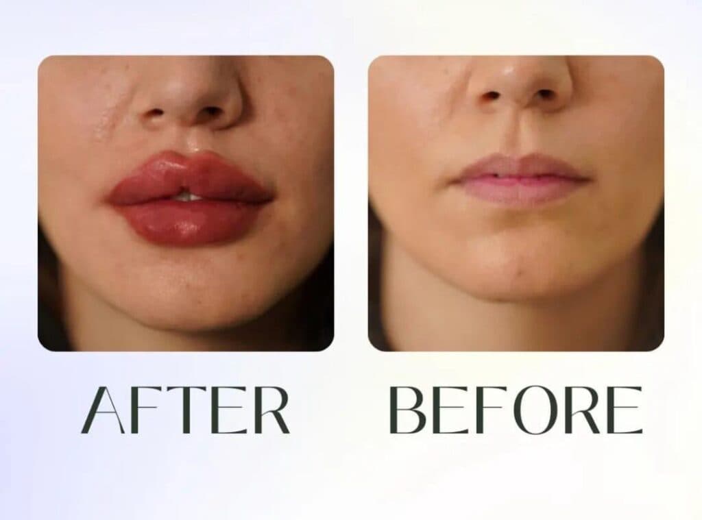 کلینیک زیبایی فلورا در مهران کرج