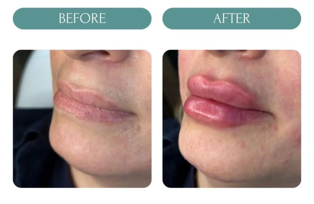 کلینیک زیبایی فلورا در مهران کرج