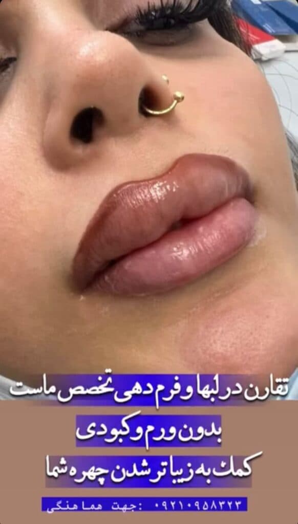 کلینیک زیبایی پوست و مو سیما در گرگان