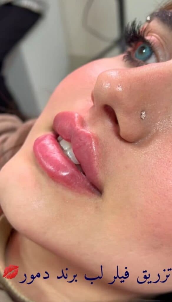 کلینیک زیبایی پوست و مو سیما در گرگان