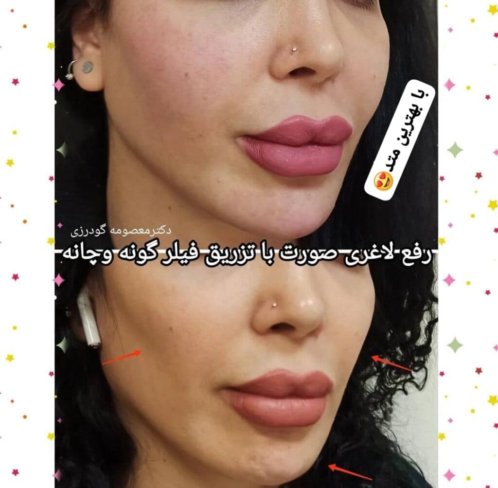 مطب زیبایی پوست و مو دکتر معصومه گودرزی در بروجرد