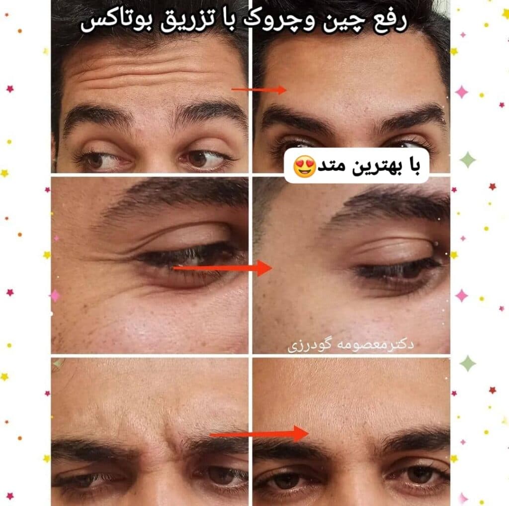 مطب زیبایی پوست و مو دکتر معصومه گودرزی در بروجرد