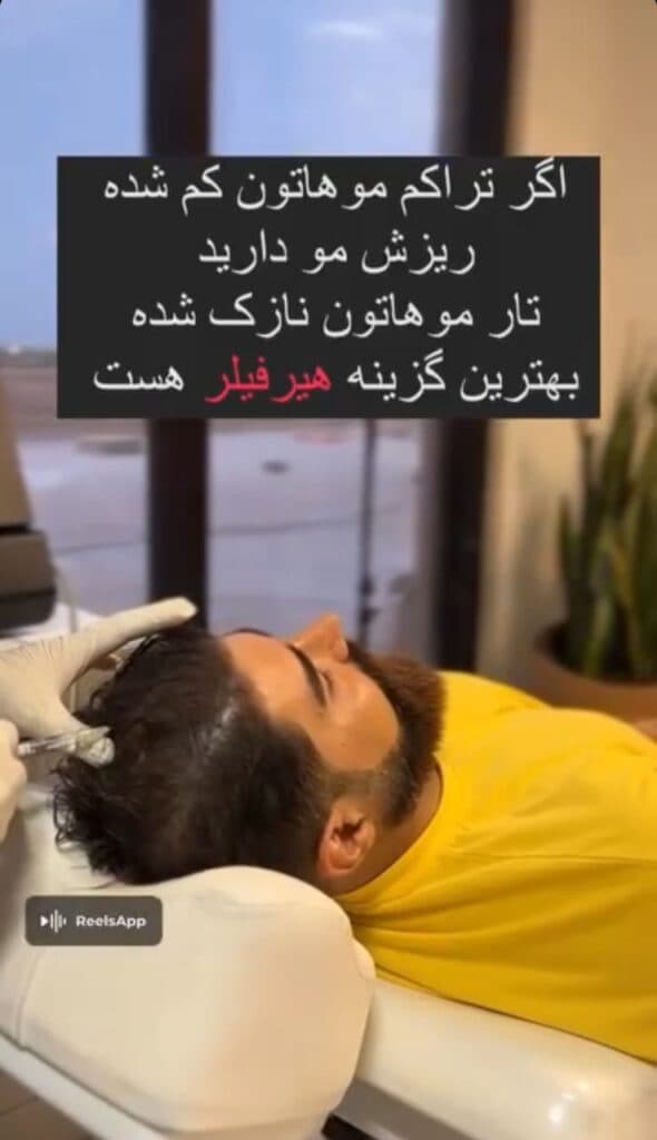 کلینیک زیبایی پوست و مو لاگوم در کیش