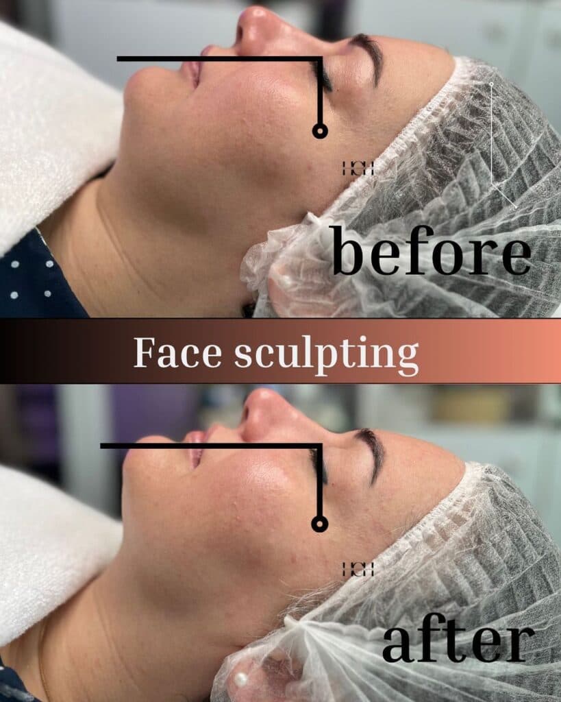 مرکز تخصصی آموزش و پاکسازی پوست هورچهر در رشت