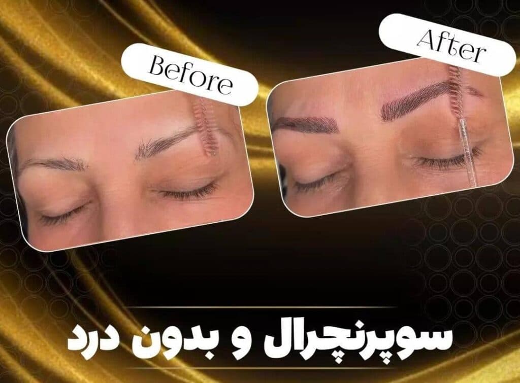 مرکز زیبایی اکسیر در چایپاره