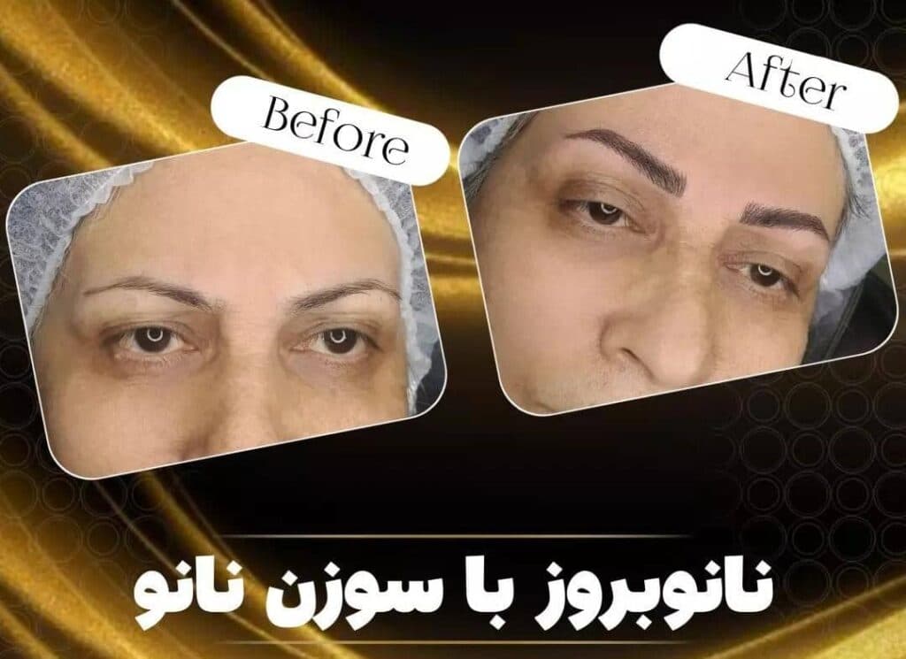 مرکز زیبایی اکسیر در چایپاره