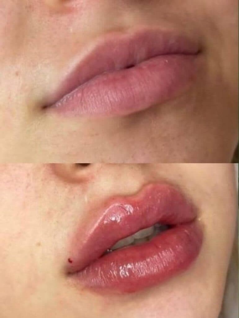 مرکز تخصصی زیبایی هرمان در تهران