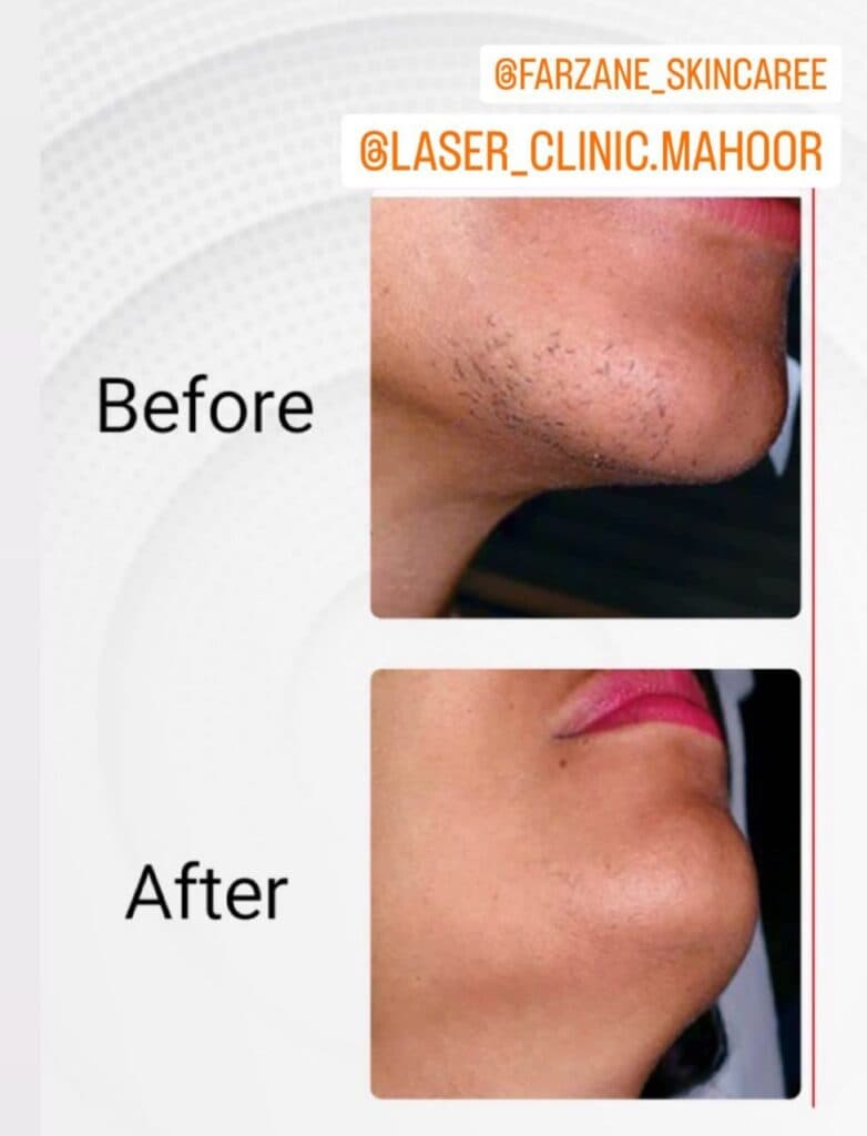 مرکز تخصصی لیزر ماهور در گرگان