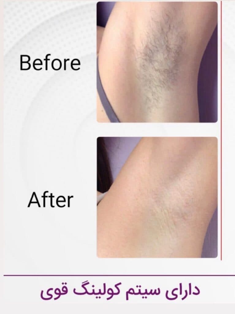 مرکز تخصصی لیزر ماهور در گرگان