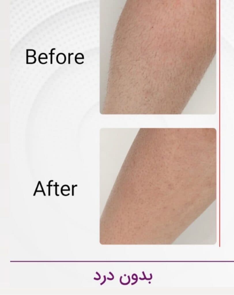 مرکز تخصصی لیزر ماهور در گرگان