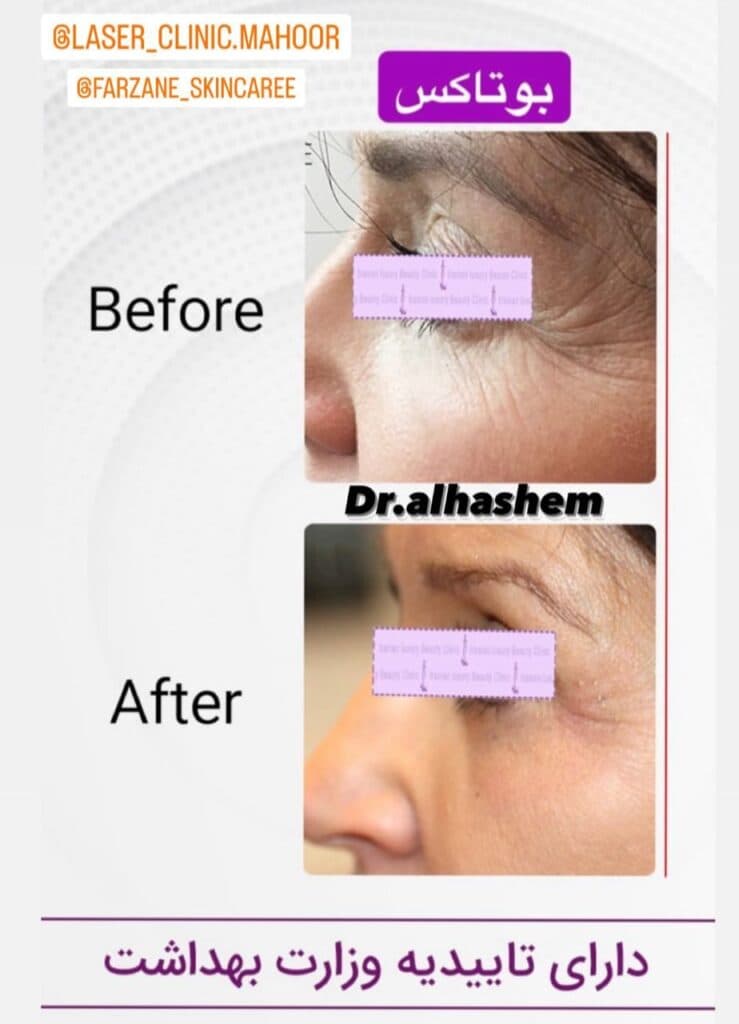 مرکز تخصصی لیزر ماهور در گرگان