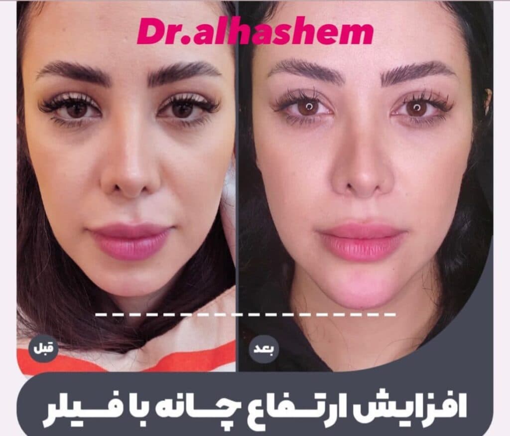 مرکز تخصصی لیزر ماهور در گرگان