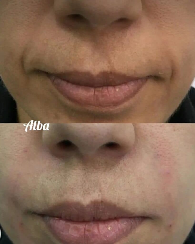 کلینیک تخصصی ژل و بوتاکس آلبا در تهران