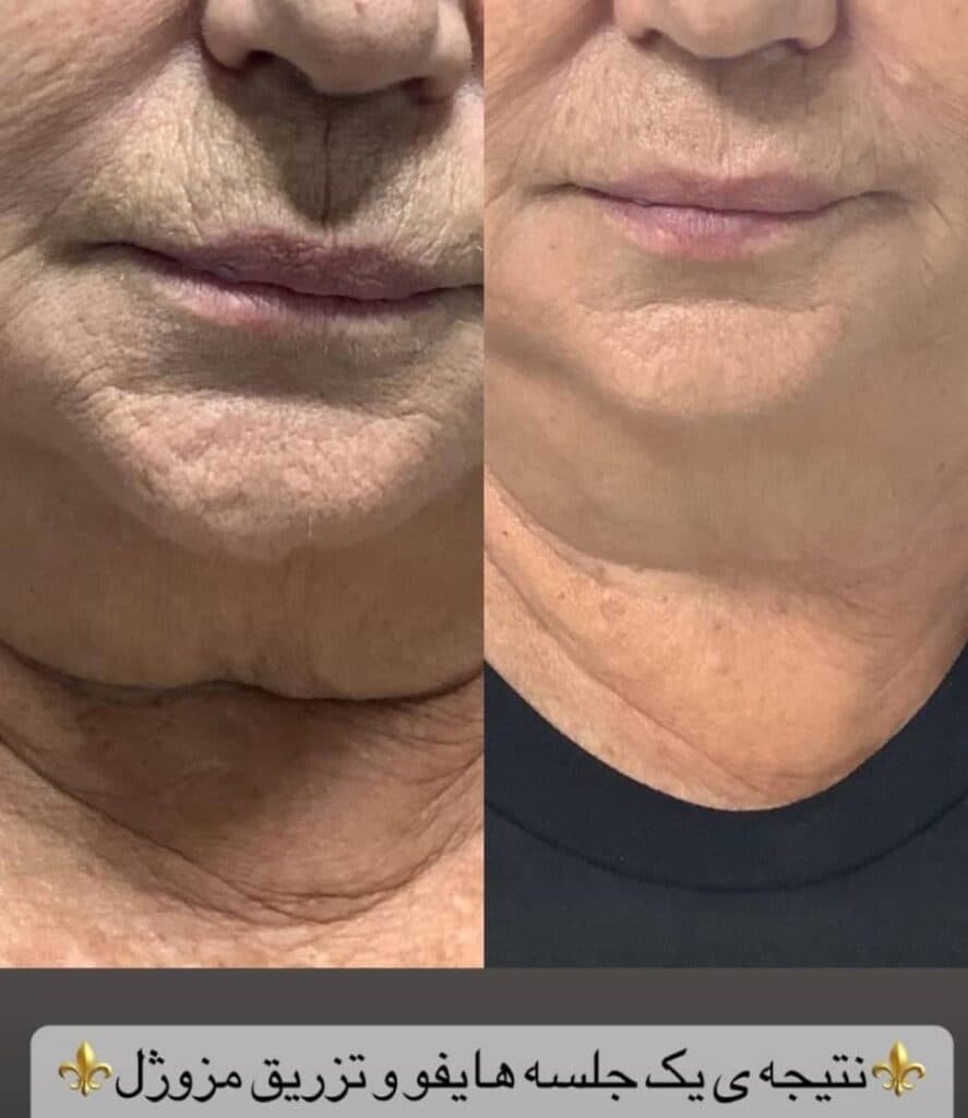 کلینیک زیبایی جواهر در تبریز