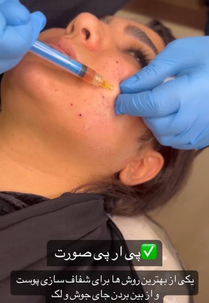 کلینیک زیبایی جواهر در تبریز