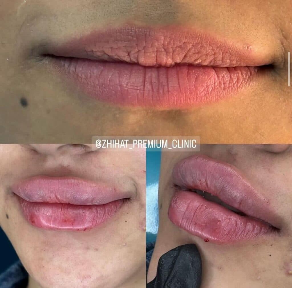کلینیک زیبایی ژی هات در بندرعباس