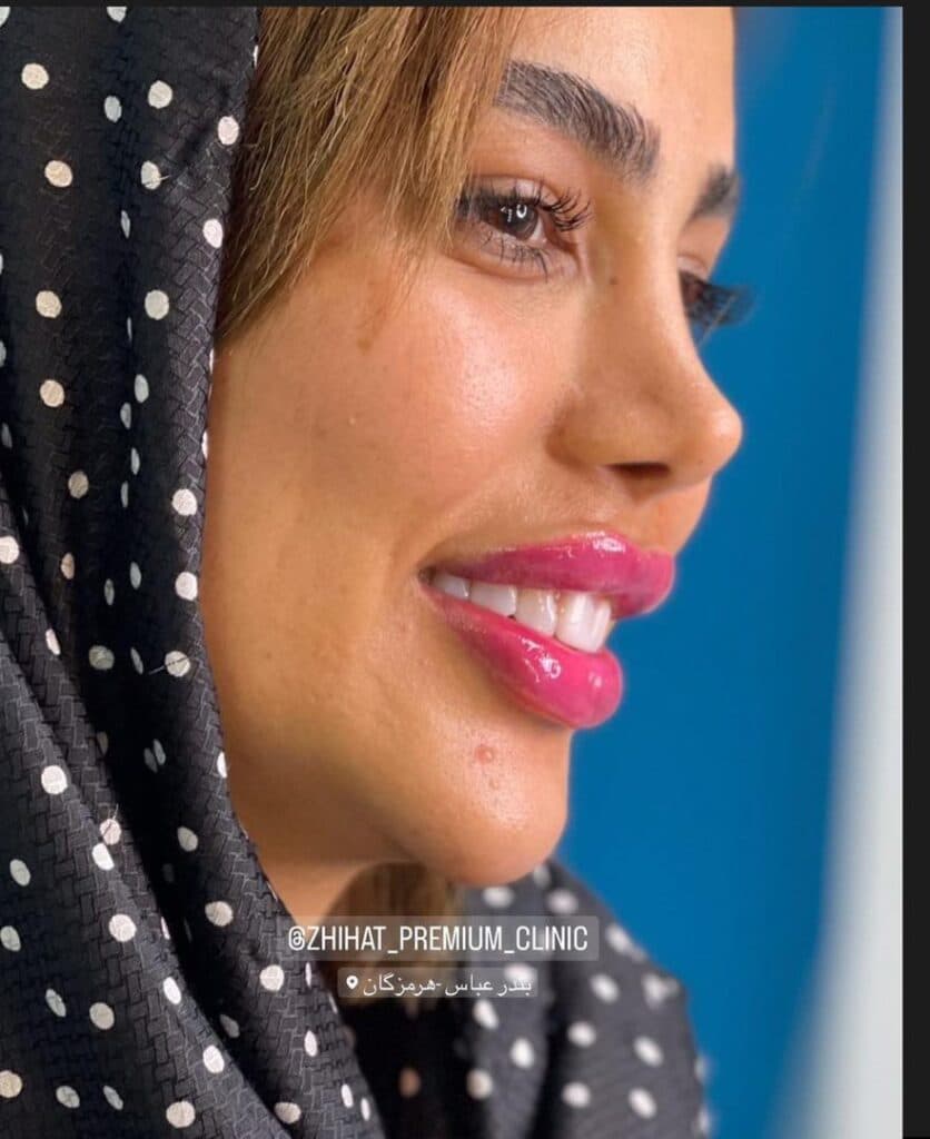 کلینیک زیبایی ژی هات در بندرعباس