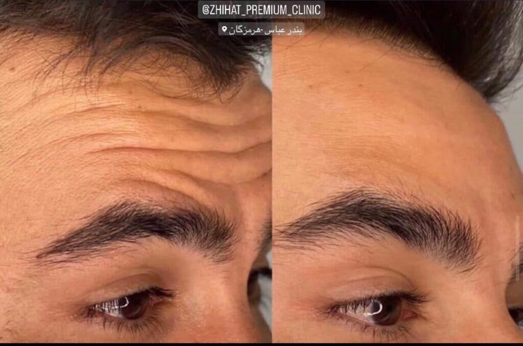 کلینیک زیبایی ژی هات در بندرعباس