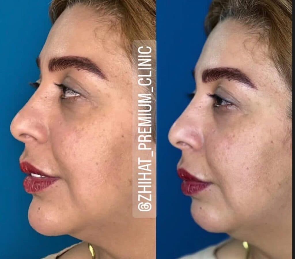 کلینیک زیبایی ژی هات در بندرعباس
