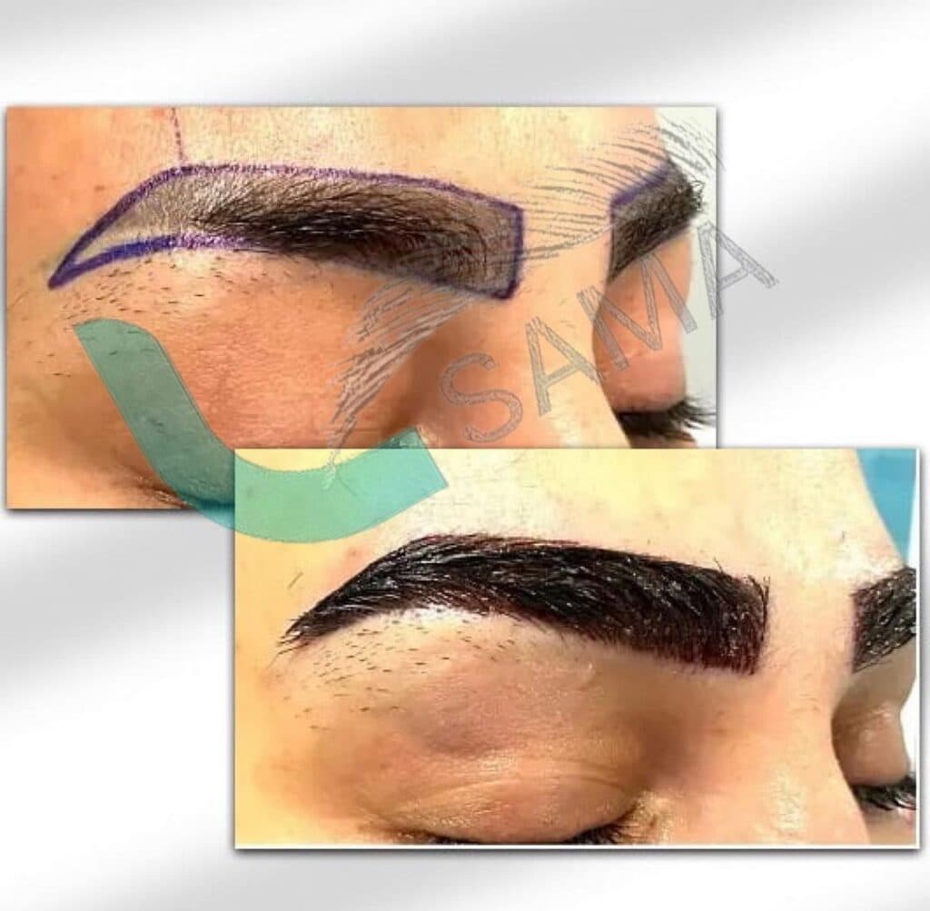 آموزش و خدمات زیبایی کاشت ابرو هویدر در شیراز