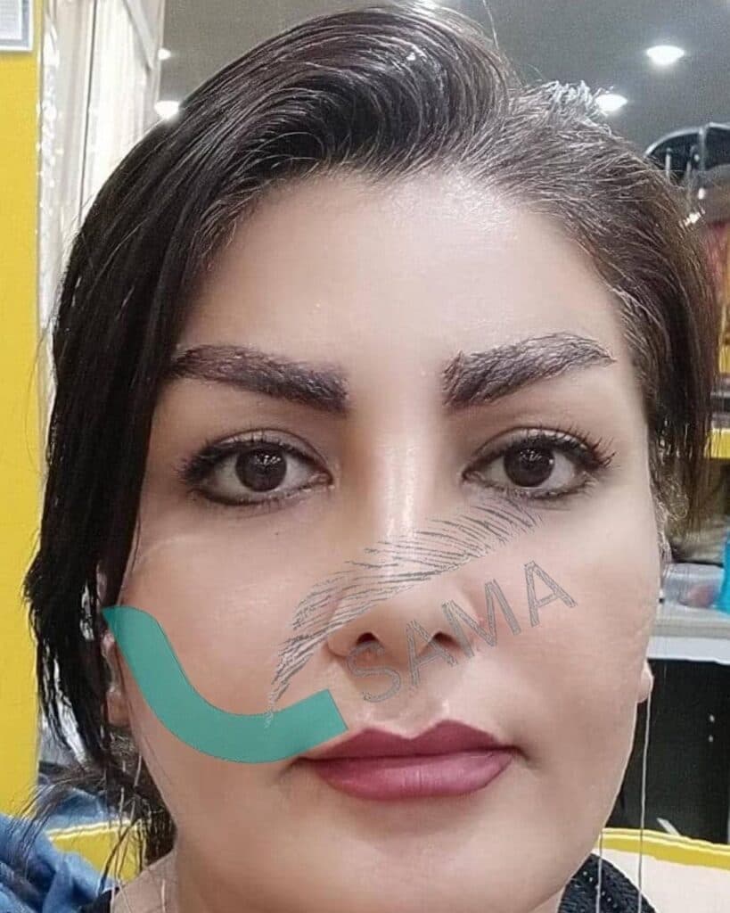 آموزش و خدمات زیبایی کاشت ابرو هویدر در شیراز