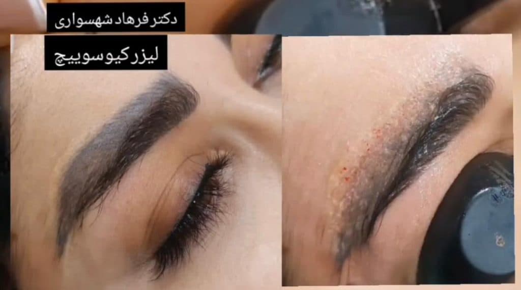 کلینیک زیبایی پوست و مو دکتر فرهاد شهسواری در عظیمیه کرج