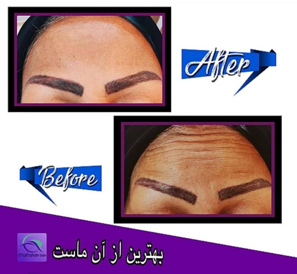 کلینیک زیبایی پوست و مو بدر در بندر ماهشهر