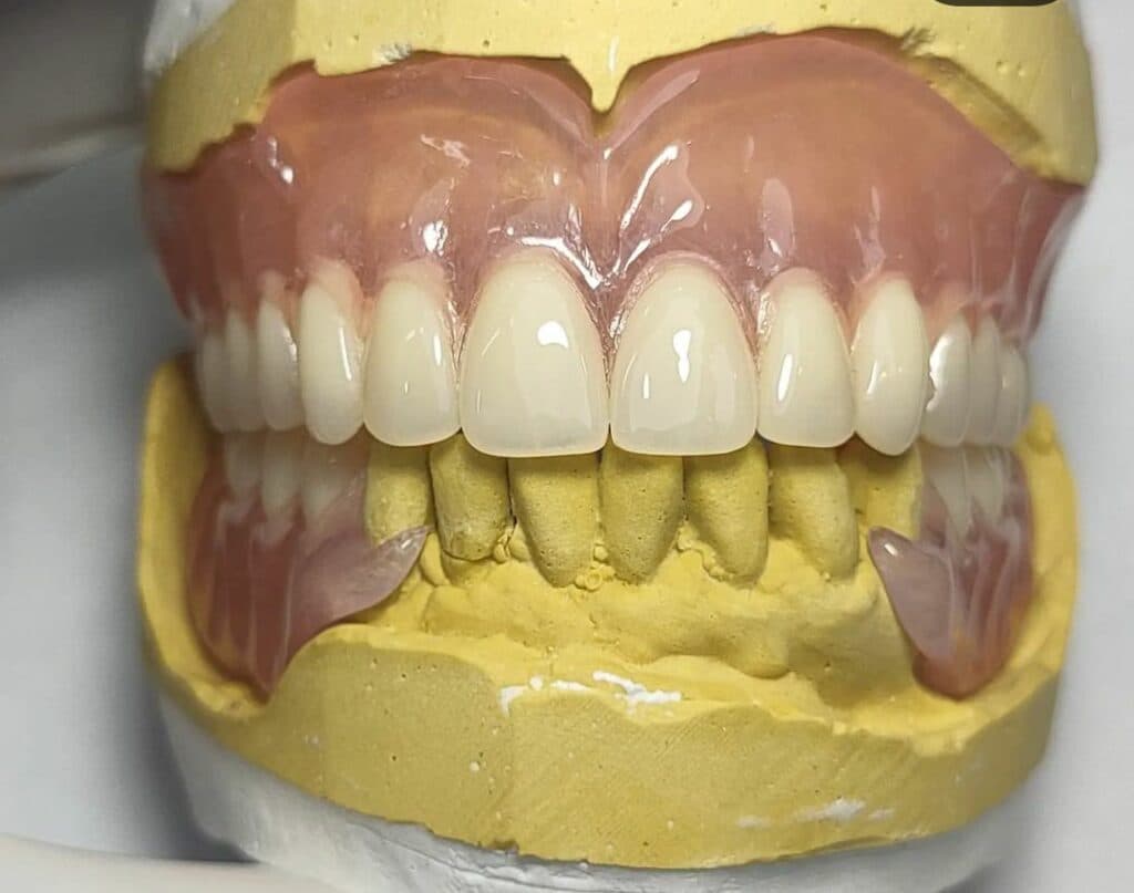 لابراتوار پروتزهای دندانی پارس در رودسر