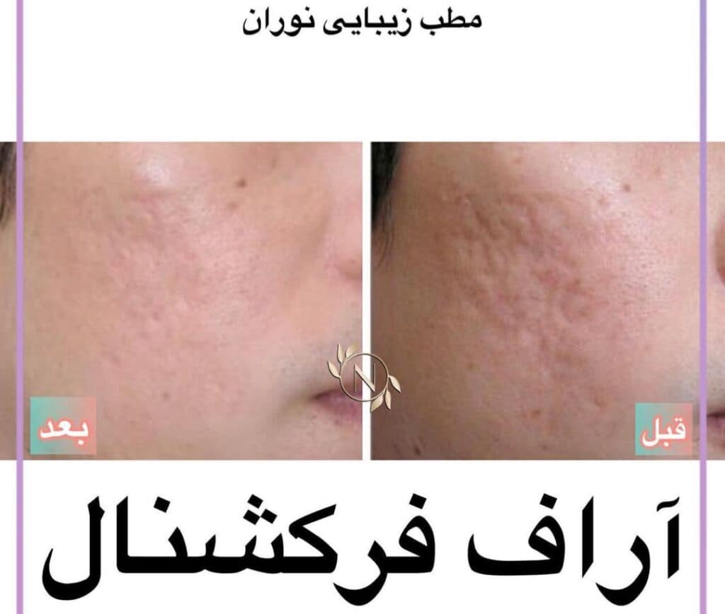 کلینیک زیبایی و لیزر نوران در صادقیه تهران