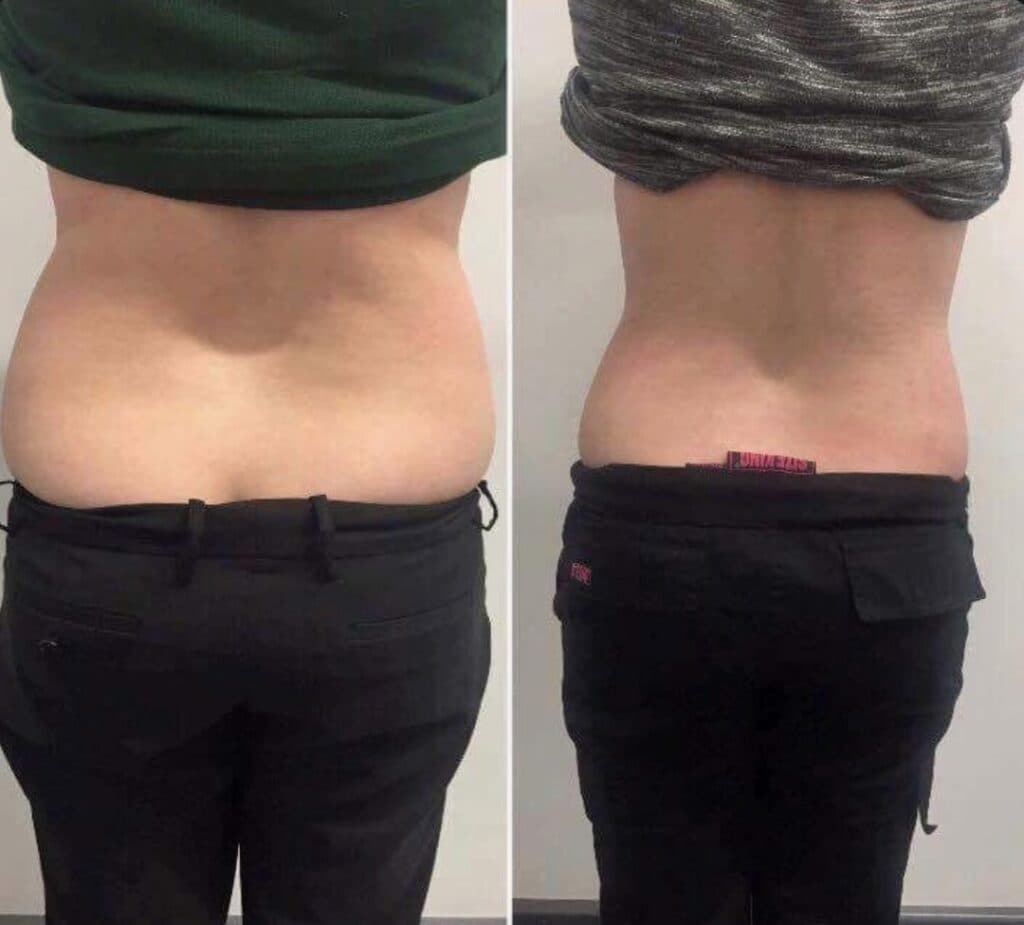 کلینیک لاغری تیروژ در اراک