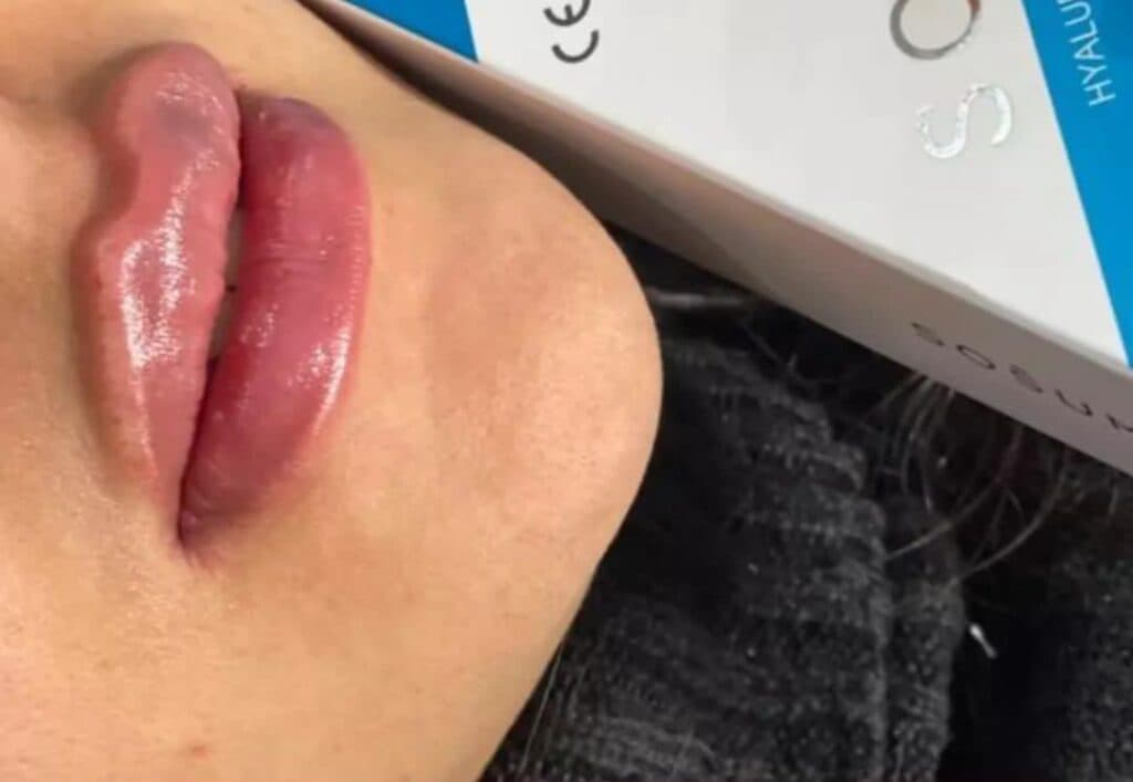 کلینیک زیبایی و لیزر زیبارویان در قم