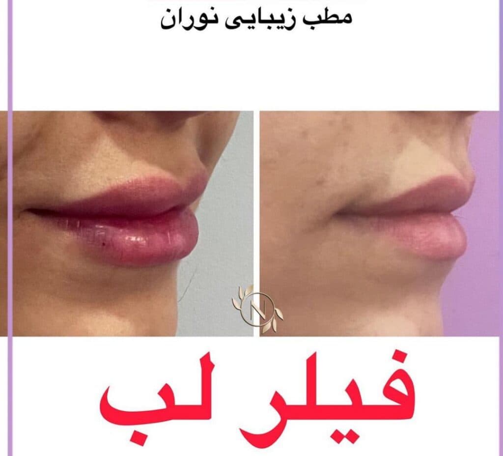 کلینیک زیبایی و لیزر نوران در صادقیه تهران