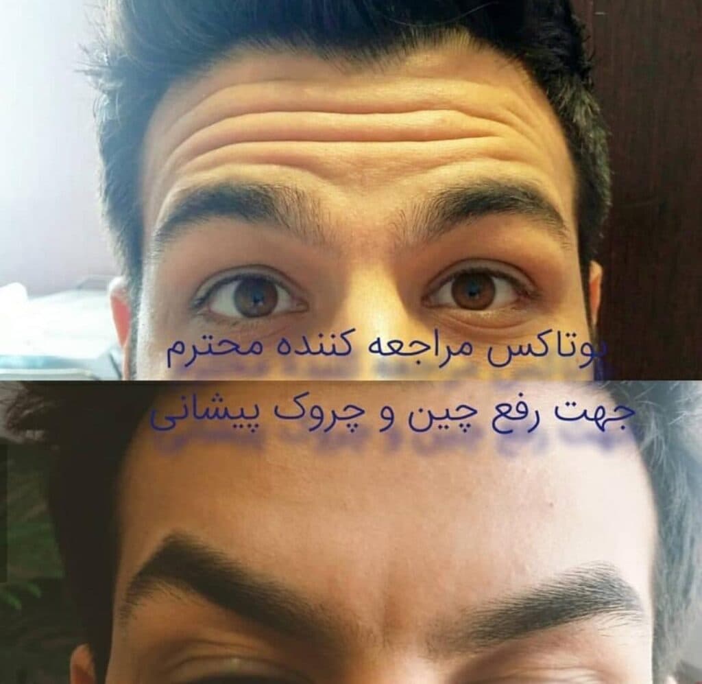 کلینیک زیبایی و لیزر زیبارویان در قم