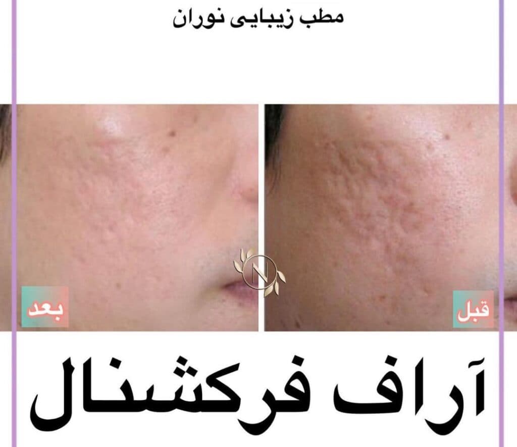 کلینیک زیبایی و لیزر نوران در صادقیه تهران