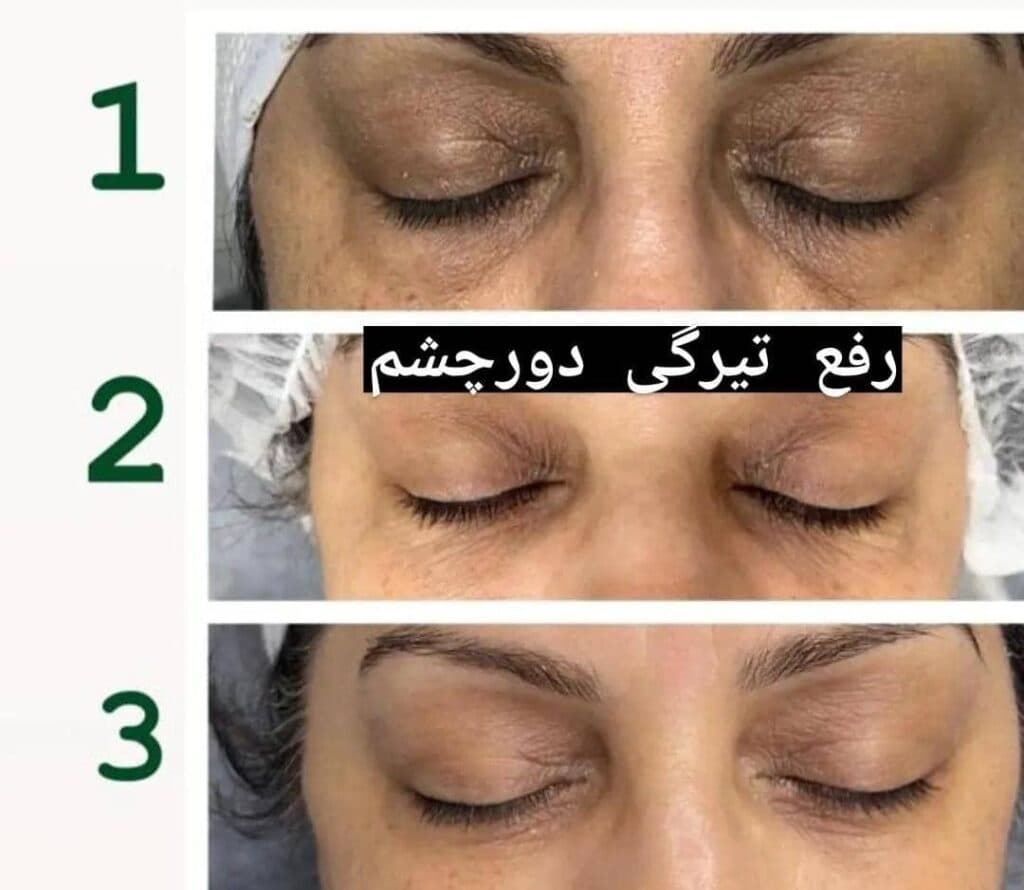 کلینیک زیبایی پوست و مو برلیان در خوزستان