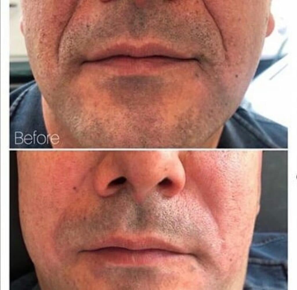 کلینیک زیبایی و لیزر زیبارویان در قم