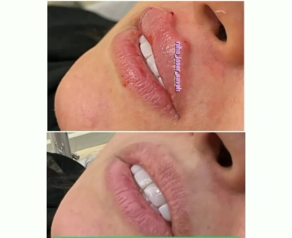 مرکز زیبایی لیزر رها در ساوه