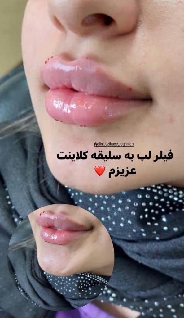 کلینیک زیبایی پوست و مو لقمان در شوش دانیال