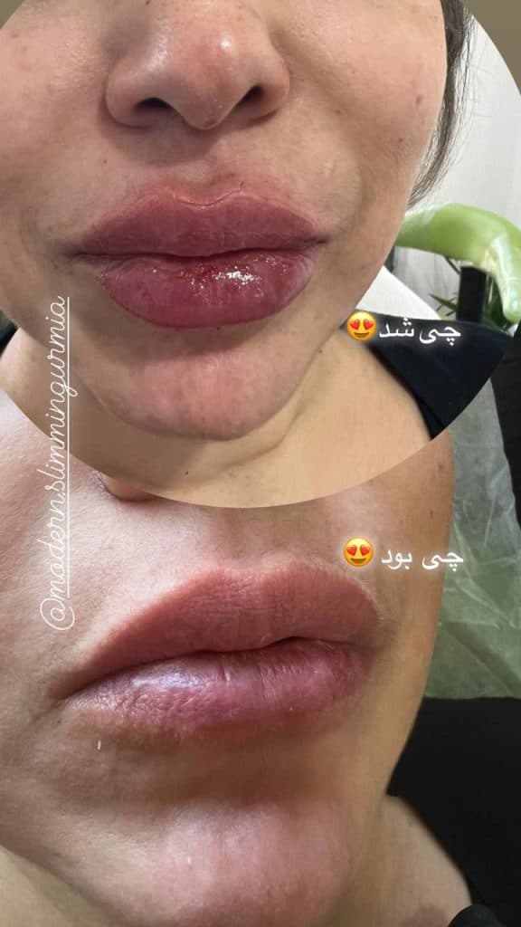 مرکز لاغری مدرن در ارومیه