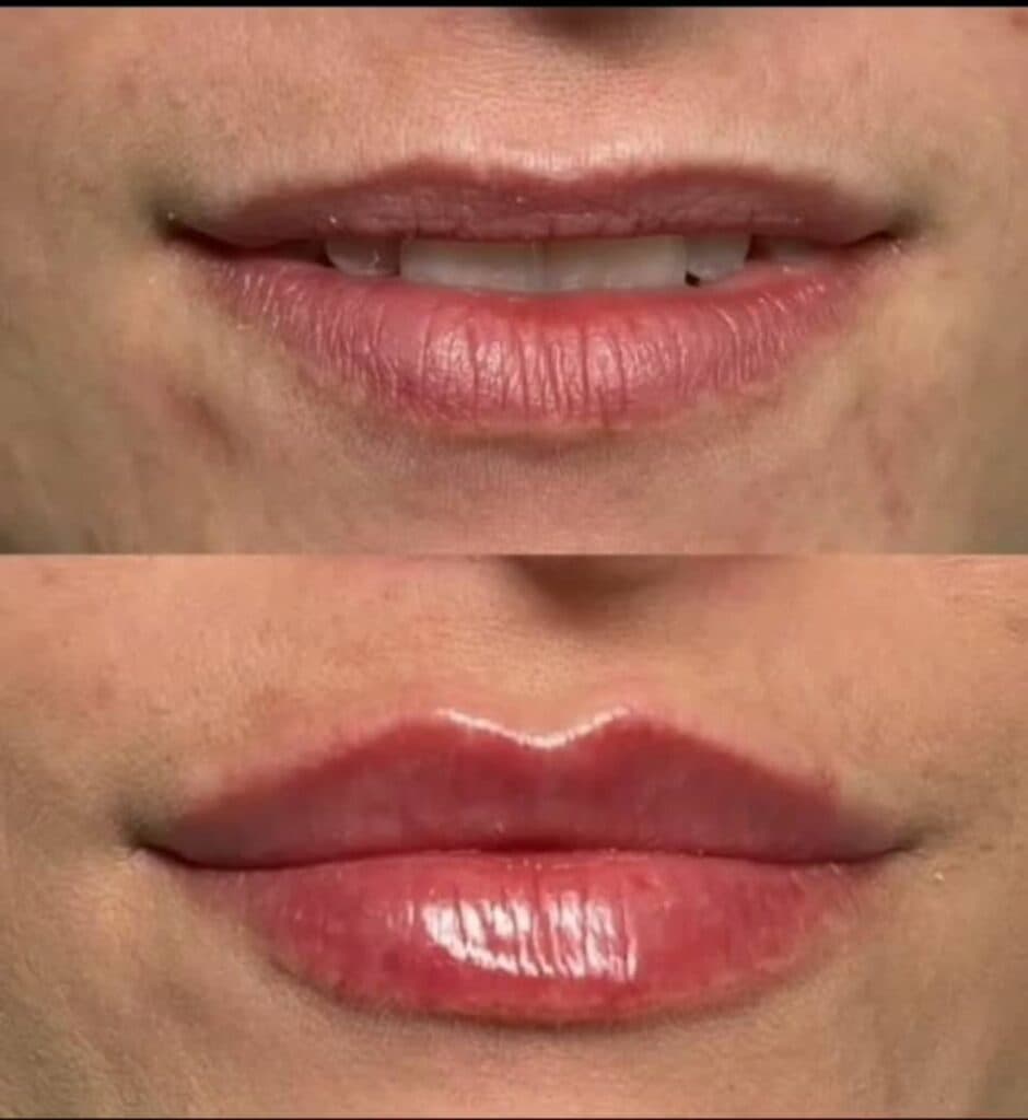 مرکز زیبایی لیزر رها در ساوه