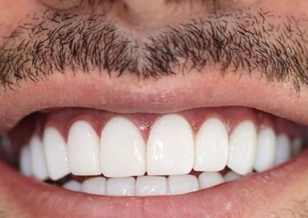 دندانپزشکی شاین در کرج