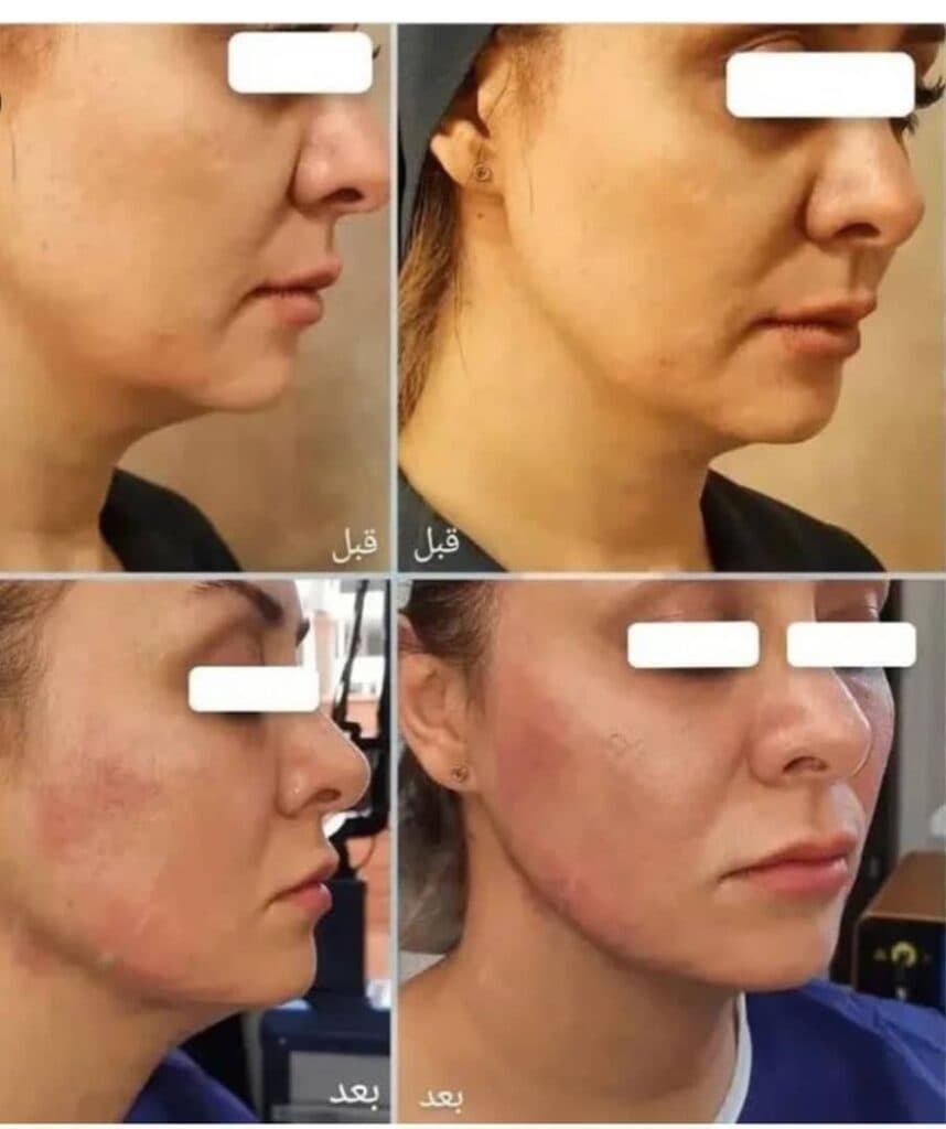 مرکز زیبایی لیزر رها در ساوه