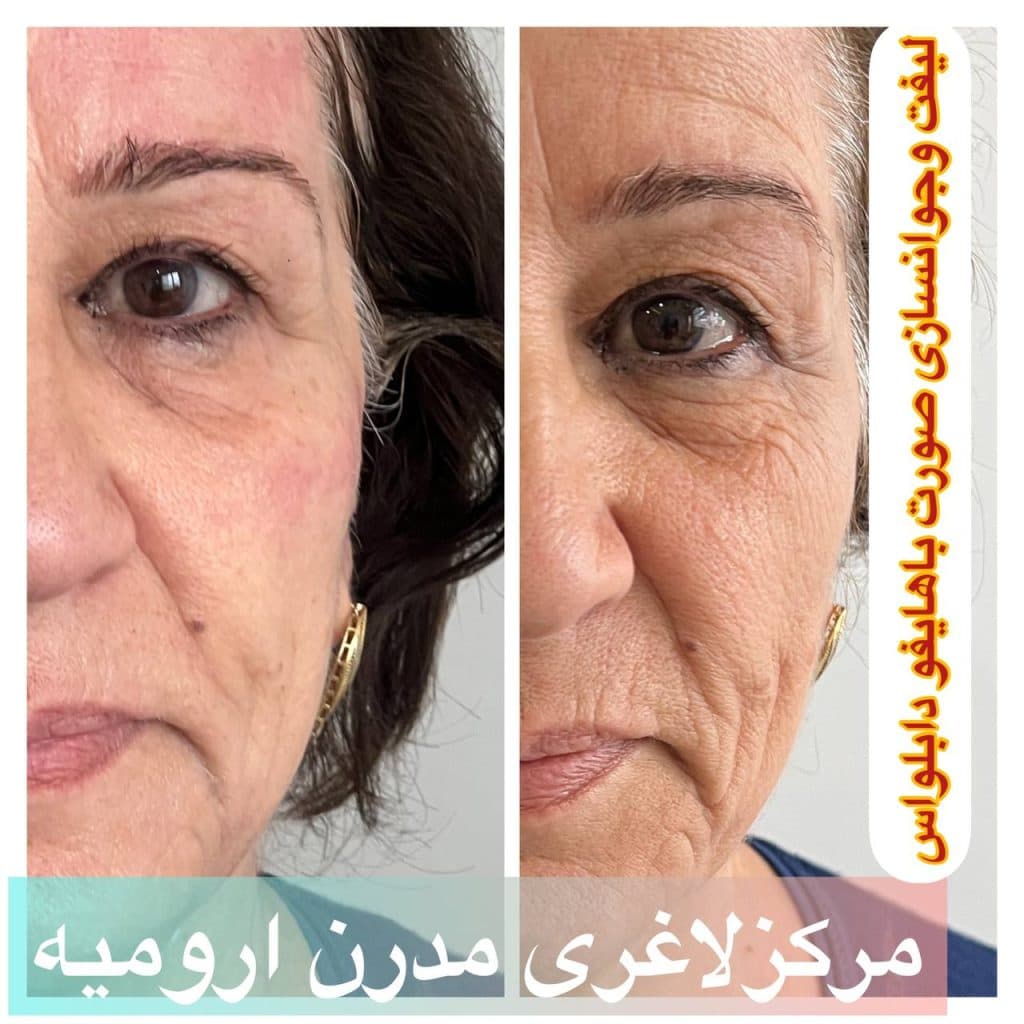 مرکز لاغری مدرن در ارومیه