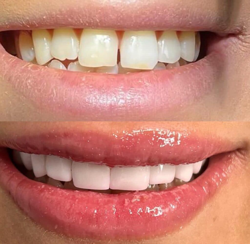 خدمات تخصصی بیهوشی دندان بزرگسال و اطفال ادیب در توحید اصفهان