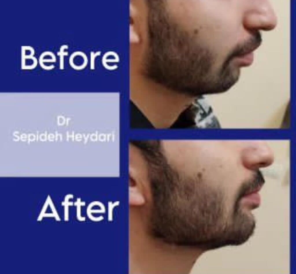 مطب زیبایی دکتر سپیده حیدری در سهند