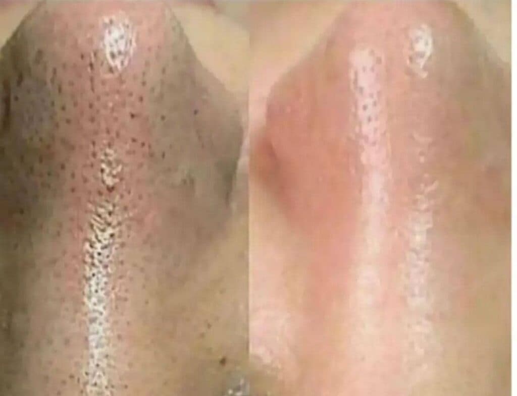 مشاوره و خدمات زیبایی پوست و مو لدورا علوی در آمل