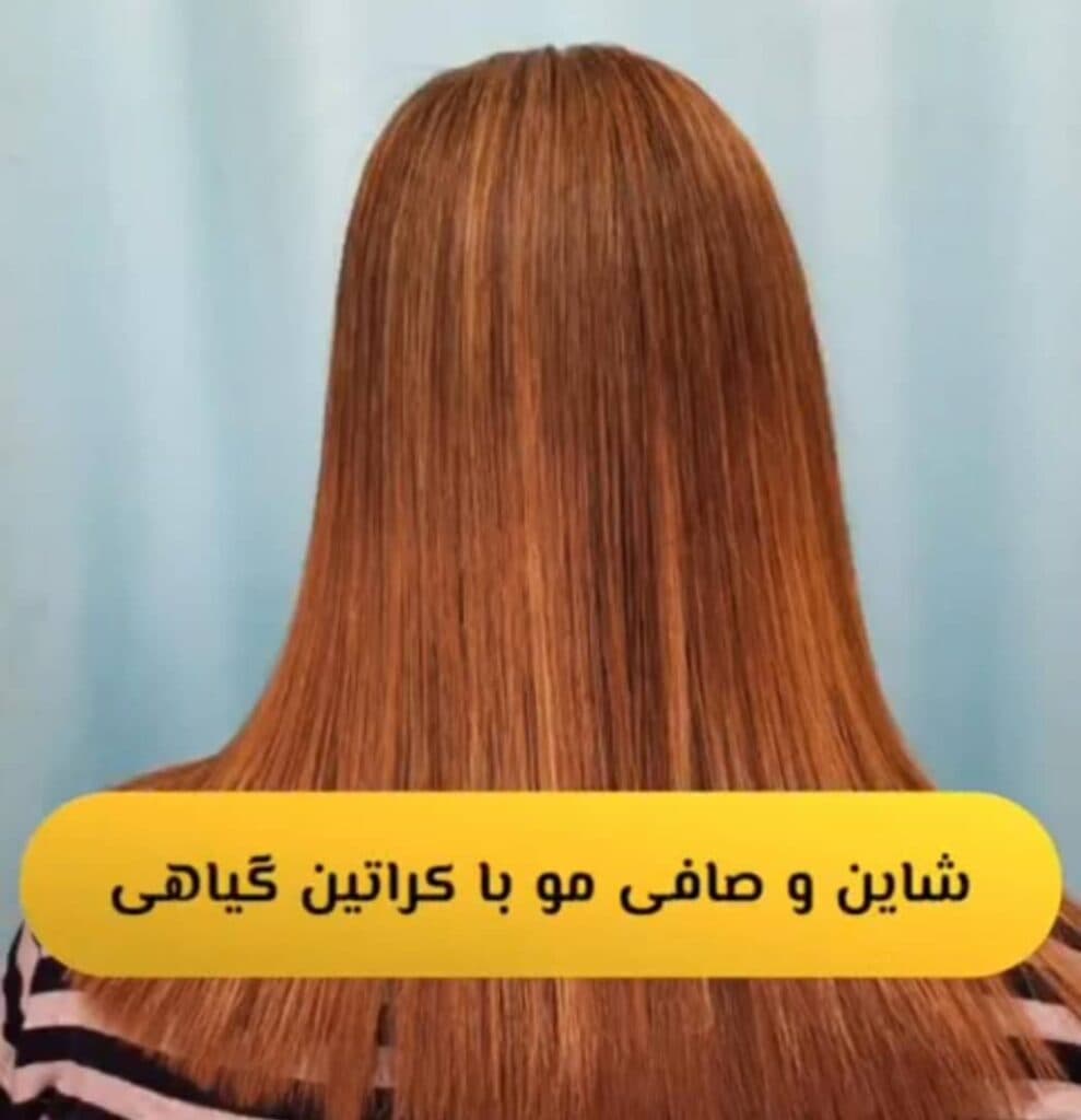 مرکز تخصصی پوست و مو هلما در صومعه سرا