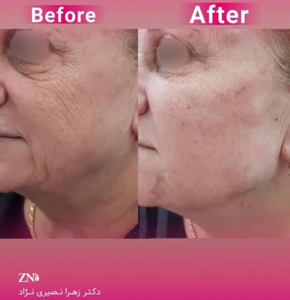 مطب زیبایی پوست و مو دکتر زهرا نصیری نژاد در شیراز