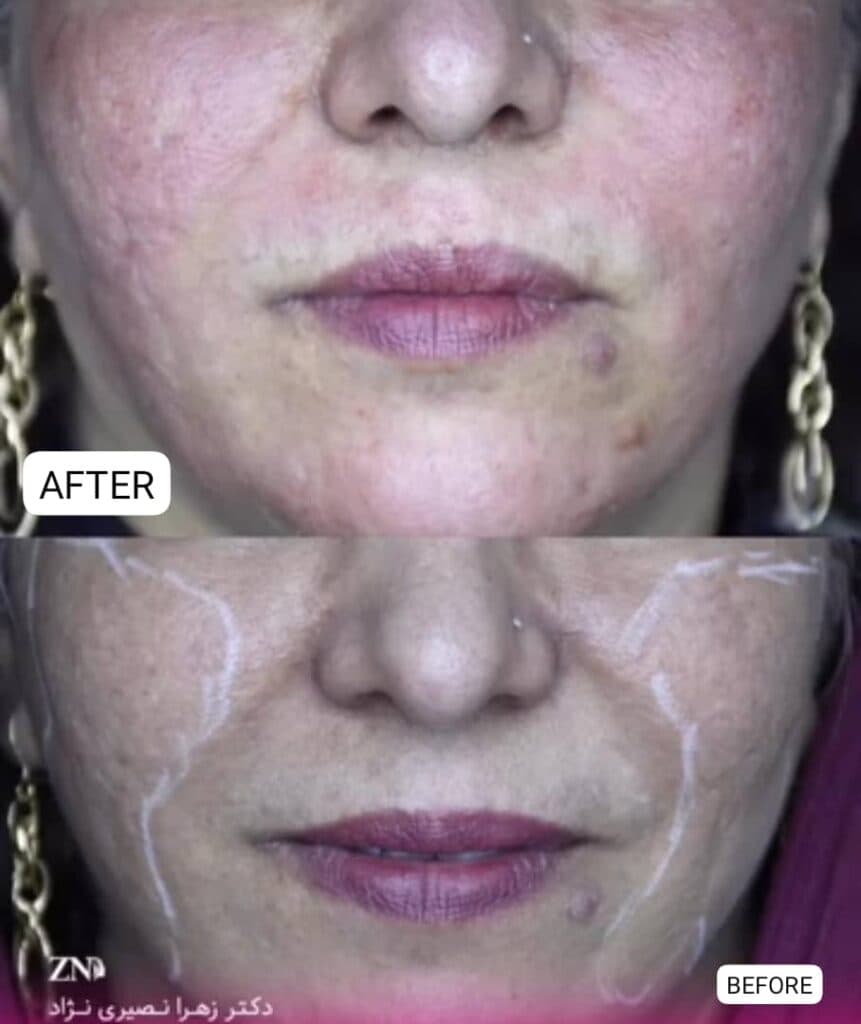 مطب زیبایی پوست و مو دکتر زهرا نصیری نژاد در شیراز
